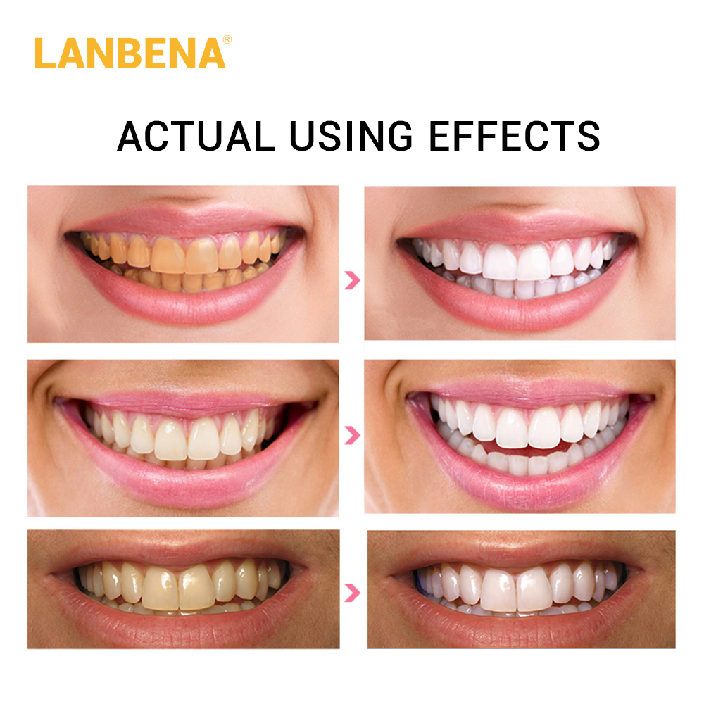 LANBENA Teeth Whitening Strip 1PCS Teeth Veneers White Strip Removes Plaque Stains Powder Oral Hygiene Bleaching Dental Tool
