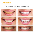LANBENA Teeth Whitening Strip 1PCS Teeth Veneers White Strip Removes Plaque Stains Powder Oral Hygiene Bleaching Dental Tool