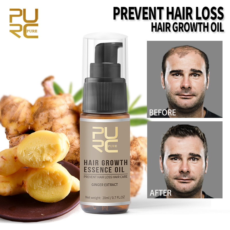 New Fast Hair Growth Ginger Essence Oil Hair Loss Treatment Helps Hair Growth Hair Care 20ml TSLM1