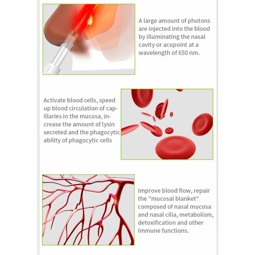 Hayfever rhinitis cure LLLT 650nm laser therapy device for Sale, Hayfever rhinitis cure LLLT 650nm laser therapy device wholesale From China