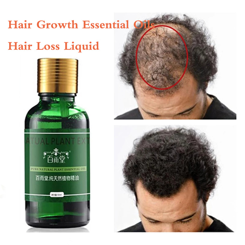 Hair Care Hair Growth Essential Oils Essence Original Authentic 100% Hair Loss Liquid Health Care Beauty Dense Hair Growth Serum