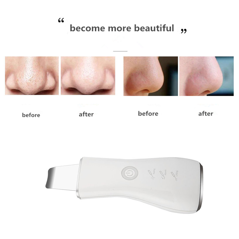 Ultrasound Iron Cleanser Cosmetic Skin Scraper Deep Cleansing Blackhead Remover with Steel Facial Spatula Tool Skin Care Tool