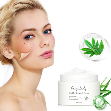 OMY LADY Freckle Removal Face Cream Anti Wrinkle Whitening Nourishing Removing Spots Reparing Scar Acne Treatment Skin Care