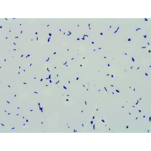 High Stability 100 Billion CFU/g Lactobacillus Reuteri