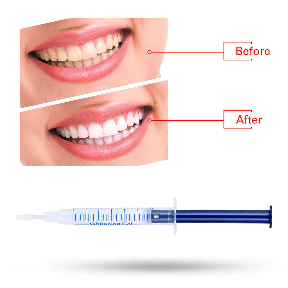 10 Gel 1 LED White Tooth Bleach Hot Teeth Whitening Carbamide Peroxide Dental Bleaching System Oral Gel Kit 3D Oral Hygiene