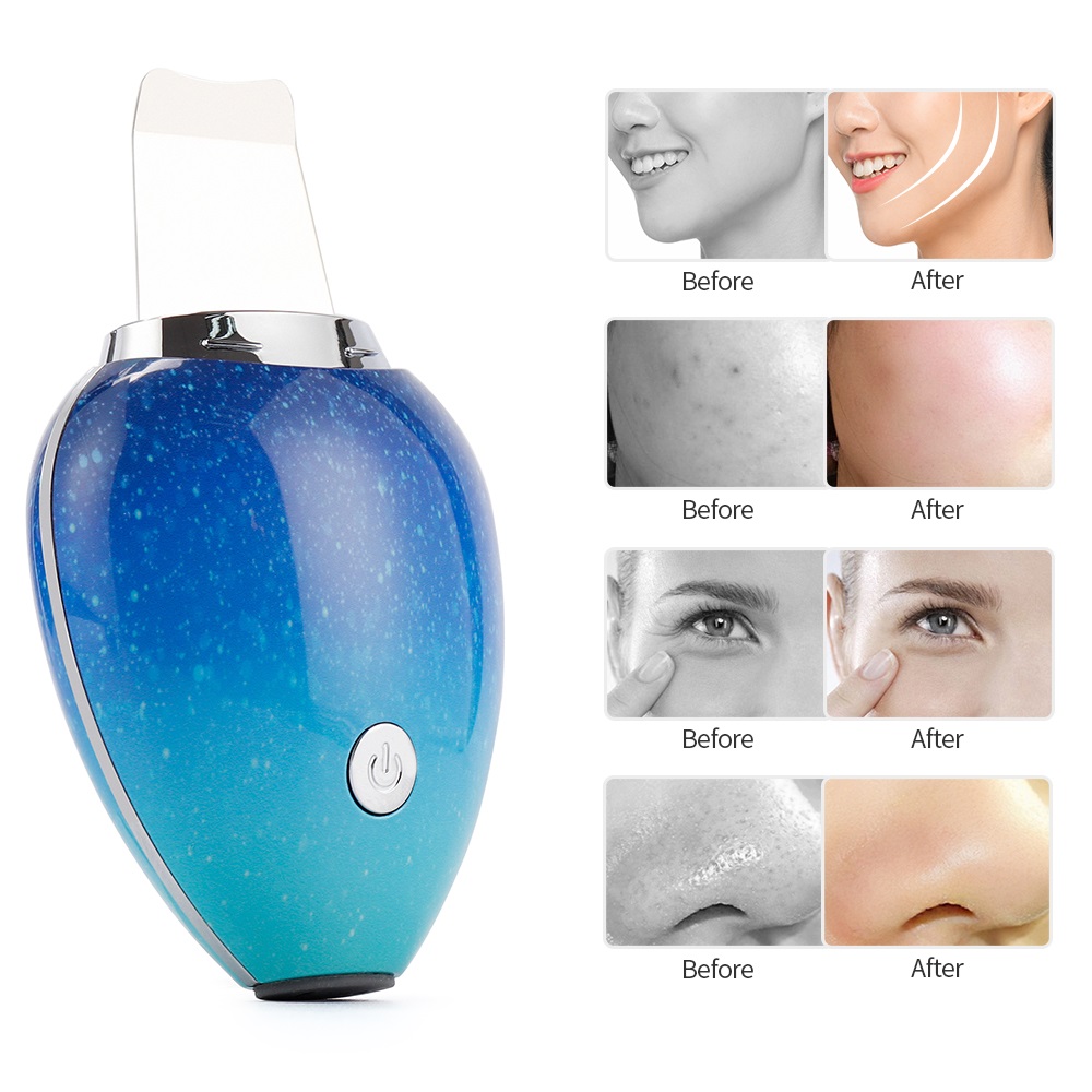 Ultrasonic Ion Cleaning Blackhead Remover Skin Scrubber EMS Peeling Pore Cleaner Exfoliation Face Skin Srubber Lifting Device