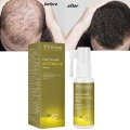 New Fast Hair Growth Essential Oil 30ml Hair Loss Products Treatment Regrowth Ginger Serum Essence Hair Care for Women Men