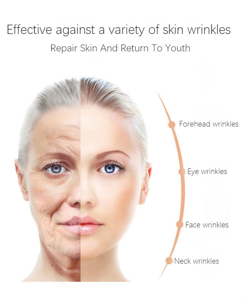 3pcs CHUMOLEE six peptides Face Serum Anti-Aging Wrinkle essence cream Moisturizing Whitening Firming Skin Care serum