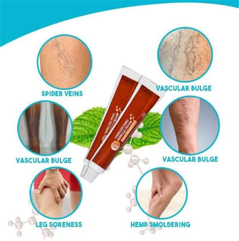 Anti-Spider Veins Cream Herbal Medicine for Varicose Veins Ointment Vasculitis Inflammation Leg Massage Varicose Veins Cream