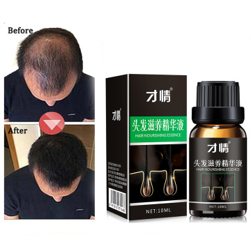 Hair Growth Products Natural With No Side Effects Faster Grow Hair Treatment Restore Regrowth Pilatory Anti Hair Loss Products