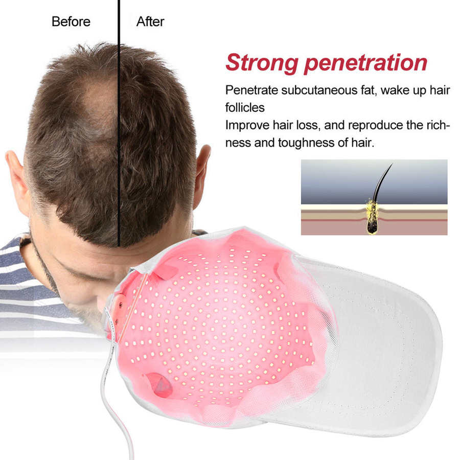 108/118/200/280pcs Lamp Beads Hair Growth Laser Helmet Therapy Anti-Hair-Loss Adjustable Cap Light Chip Hair Treatment Hat