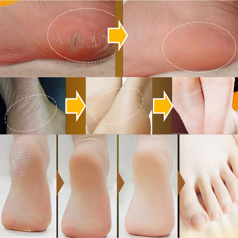 Exfoliating Foot Creams Traditional Chinese Cosmetics Hand Cracked Heel Cream Anti Dry Crack Repair Heel Feet Care Foot Balm