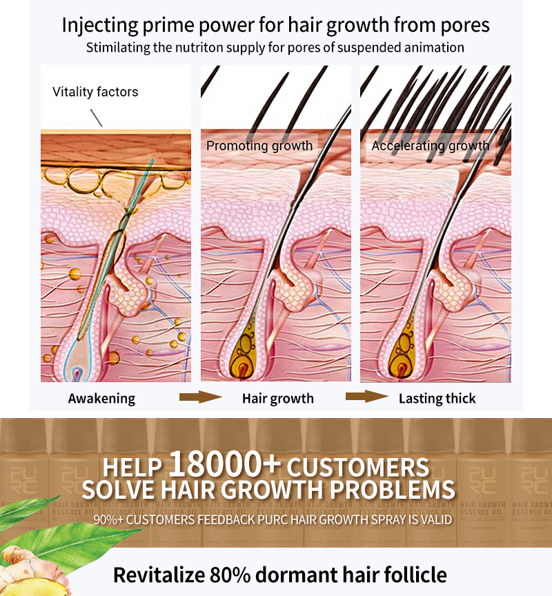 PURC New Hair Growth Spray Fast Grow Hair Loss Treatment For Thinning Preventing Hair Loss 30ml