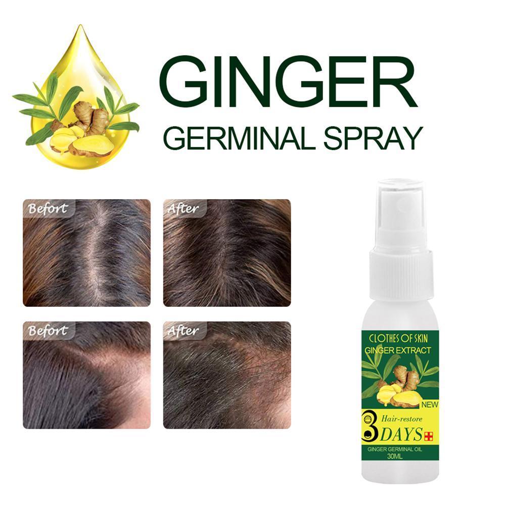 30ml Natural Ginger Essence Hairdressing Hairs Mask Essence Care Hair Ginger Hair Oil Care Loss Growth Treatment Hair W9Z4