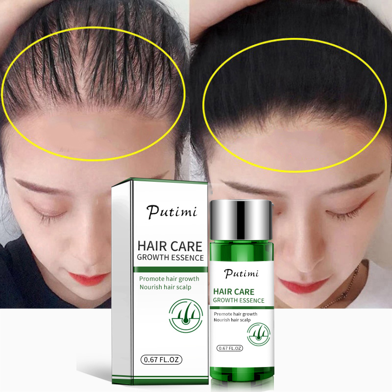 Putimi Natural Hair Growth Essence Anti Hair Loss Serum Health Care Dense Beard Hair Growth Serum HairCare Regrowth Treatment