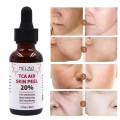 Tca Aid Skin Peel Face Serum Trichloroaectic Acid 20% Skin Peel Pore Minizing Wrinkles Spots Skin Care Face Serum 30ml