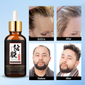 Hair Nutrition Hair Loss Treatment Solutions Product Fast Hair Growth Remedy Essence Oil Hair Regrowth Products Hair Growth