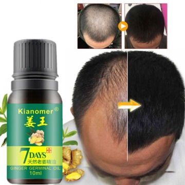 30ml Ginger Hair Growth Essential Oil Nourish Hair Follicles Anti-hair Loss Hair Care Oil