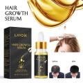 Unisex 20ml Ginger Fast Hair Growth Serum Essential Oil Anti Preventing Hair Lose Liquid Damaged Hair Repair Hair Follicle TSLM2