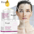 RtopR Mango Moisturizing Facial Cream Anti-Wrinkle Anti Aging Whitening Liquid Tights Nourishing Shrink Pores Hyaluronic Acid