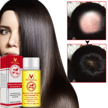 Multi-functional Nut Hair Care Growth Liquid Powerful Hair Growth Essence Hair Loss Product Essential Oil Liquid Treatment TSLM1