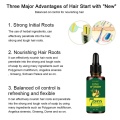 Hair Loss Treatment, Ginger Hair Growth Serum, Refreshing Oil Control Shampoo For Thicker Healthier Hair Care For Men And Women