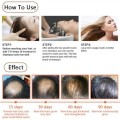 Hot 30ml Magic Fast Hair Growth Dense Regrowth Ginger Serum Oil Anti Loss Treatment Essence Bin Wild Hair Growth Tools Hair Care