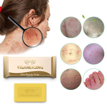 New 7g Sulfur Soap Skin Cleaning Acne Seborrhea Anti Fungus Bath Soap Anti-mite Soap Cleaner Moisturizing Portable Itching TSLM1