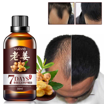 Unisex 30ml Effective Fast Hair Growth Essential Oil Hair Loss Products Treatment Regrowth Ginger Serum Essence Healthy TSLM2