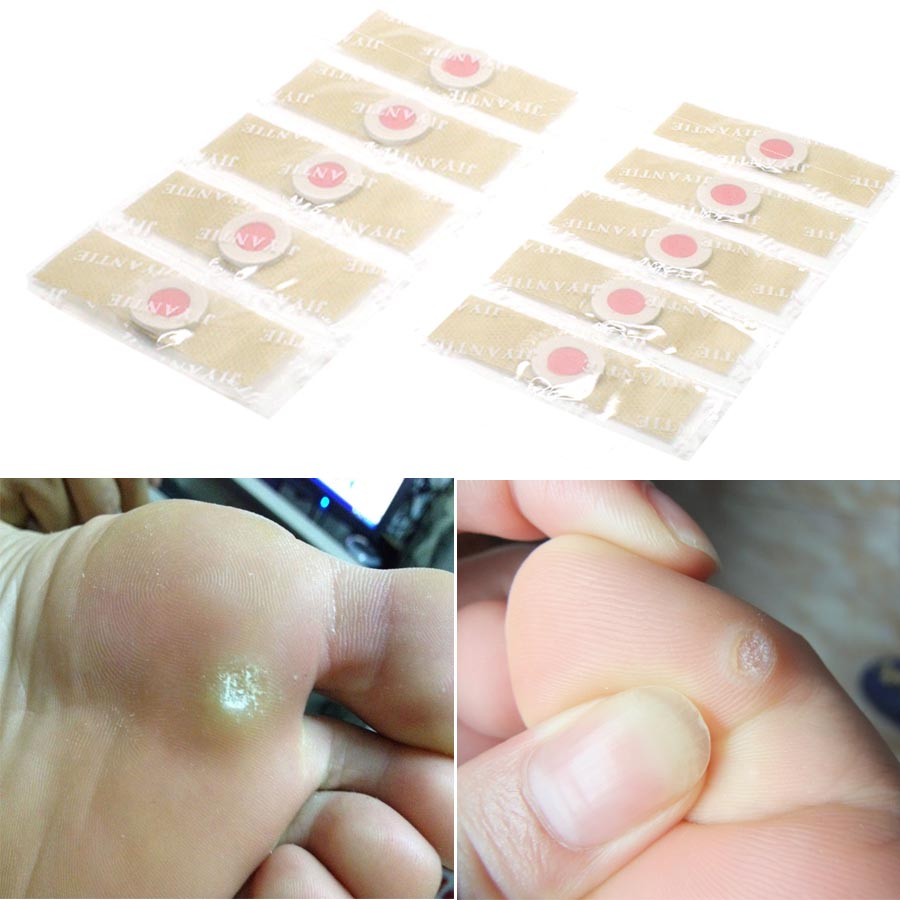 Sumifun 12/36pcs Foot Corn Removal Pain Relief Patch Calluses Plantar Warts Thorn Chinese Natural Herbal Medical Plaster
