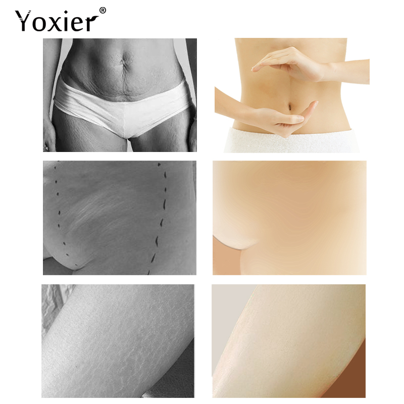 Yoxier Pearl Firming Body Lotion Slimming Cellulite Massage Remove Stretch Marks Cream Treatment Body Skin Care Health Lift Tool