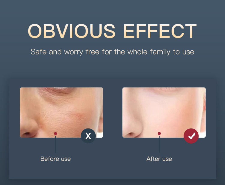 face light therapy