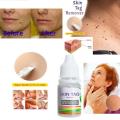 12 Hours Black Dots Mole Wart Skin Tag Remover Liquid Medical Corn Removal Foot Genital Care Mole Removal Papillomas Treatment