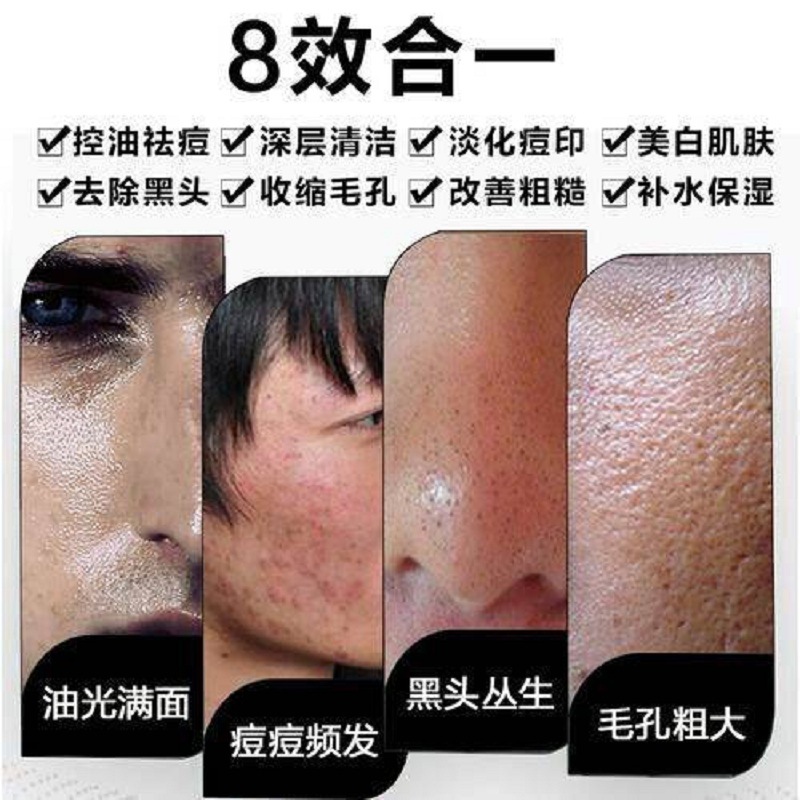 Blackheads Men Facial Cleanser Oil-control Deep Cleansing Moisturizing Foam Blackhead Skin Care Acne Treatment Facial Cleanser