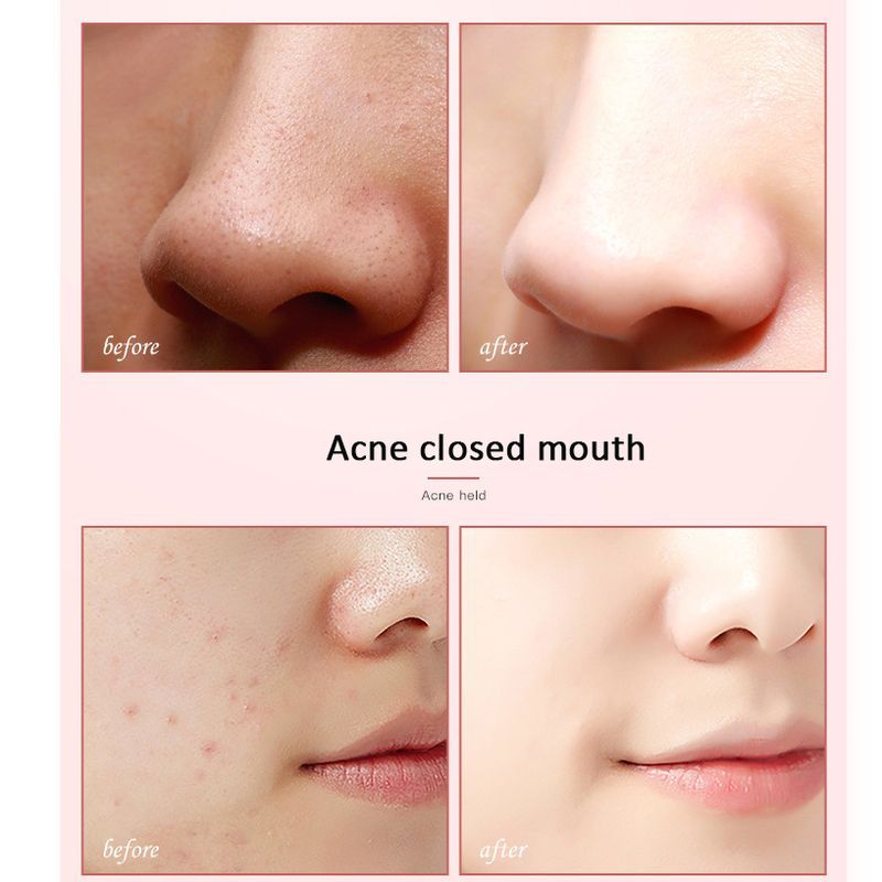 LAIKOU Cherry Amino Acid Face Wash Facial Cleanser Globular Nourishing Acne Oil-control Deep Cleansing Skin Beauty Care Wash