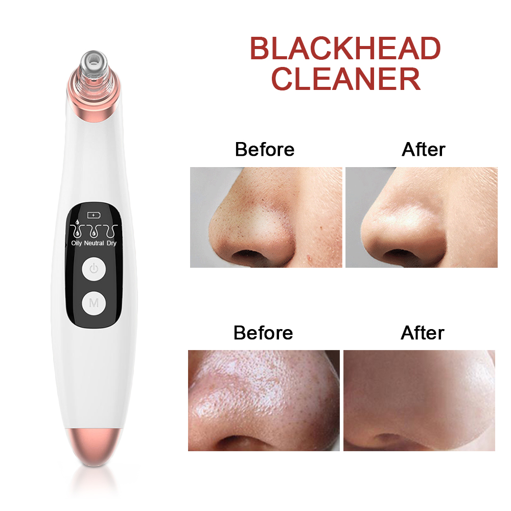 Facial Care Black Head Remover Tools For Face Care Beauty Blackhead Vacuum Cleaner Black Dots Pimple Remover Tool Face Cleaner