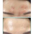 SOME BY MI AHA BHA PHA 30 Days Miracle Toner 150ml SomeByMi Facial Toner Serum Blackheads Remove Acne Treatment Skin Exfoliating