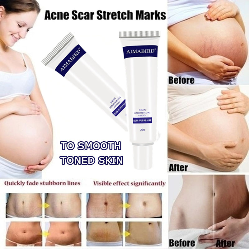 Natural Scar Repair Cream Postpartum Stretch Marks Acne Burn Pregnancy Scar Removal Smooth Body Skin Treatment&Care Products 20g