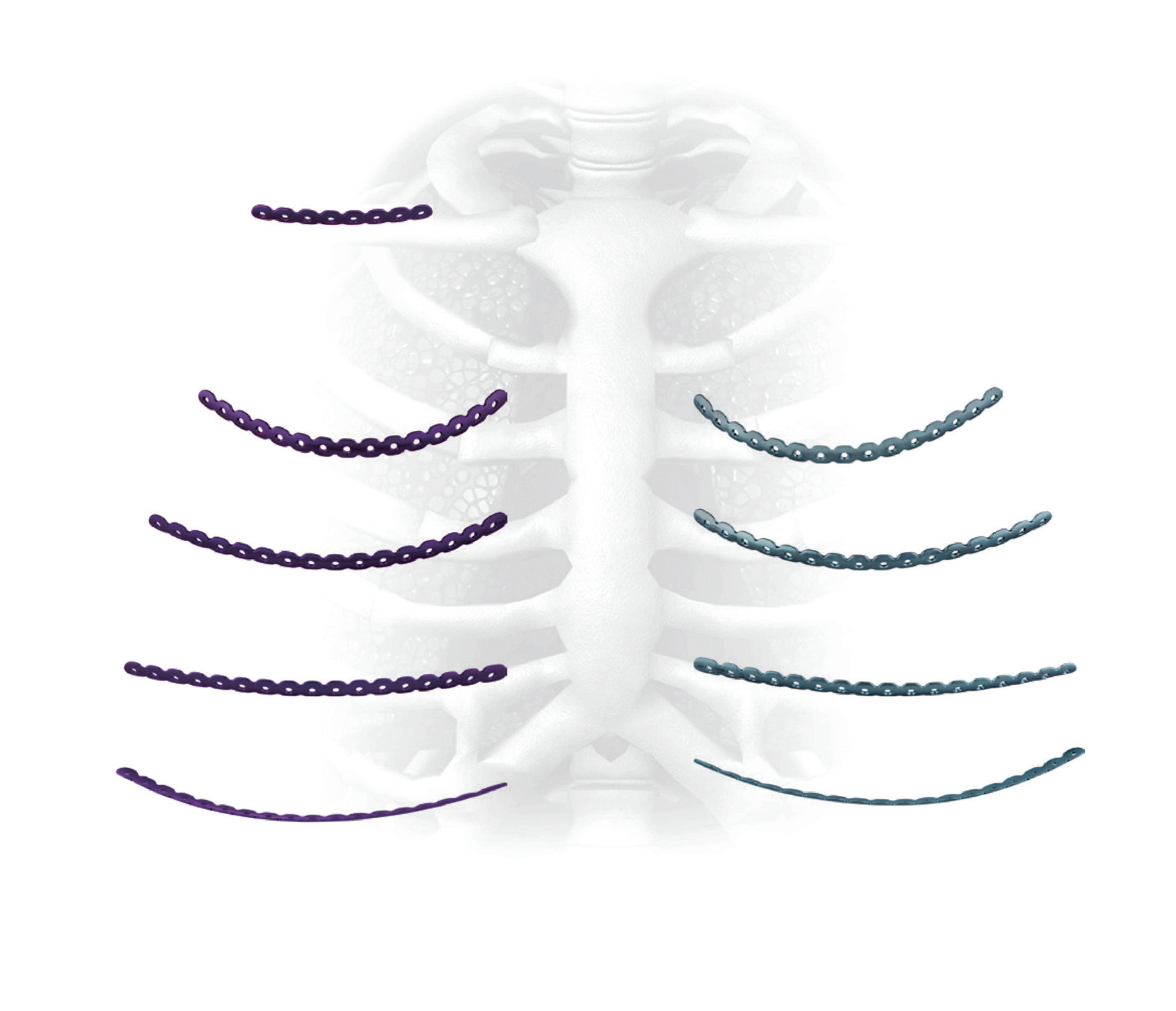 China Rib Plate,rib fracture,internal fixation surgery Manufacturer