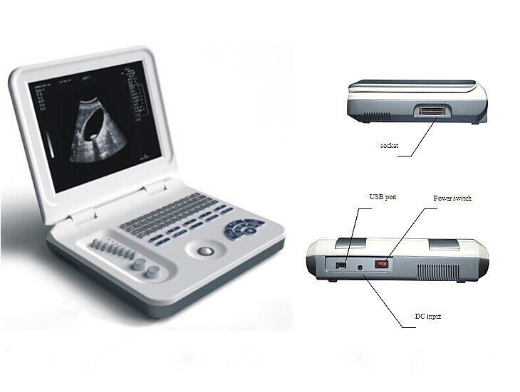 Portable Medical Equipment Laptop Ultrasound Machine Scanner Mslpu26