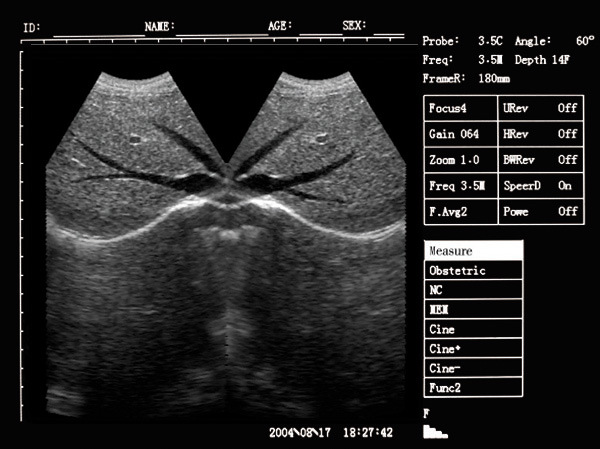 Hbw-7 B/W High Quality Laptop B Diagnostic Ultrasound Scanner