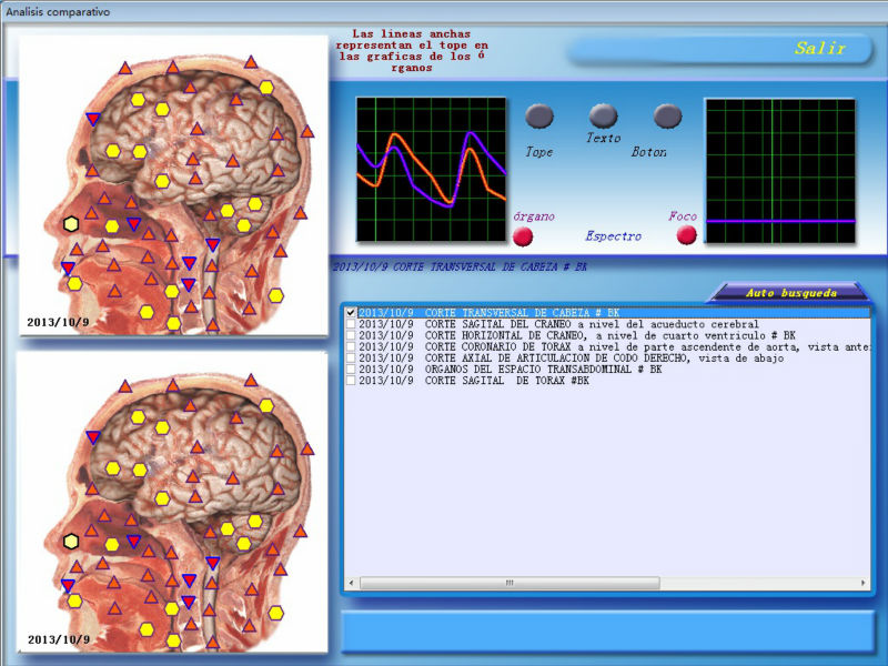 8D NLS TEST